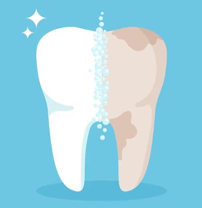 Ataşehir Diş Beyazlatma Tedavisi